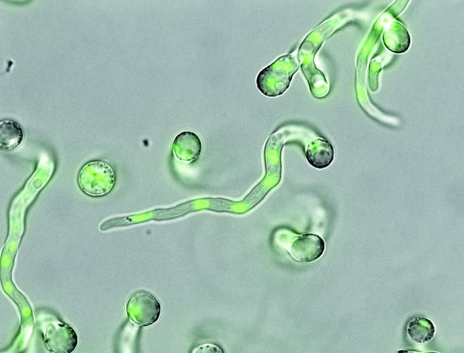 A view of Aspergillus niger with the fungus’ DNA highlighted in green | Photo Courtesy of: PNNL. A view of Aspergillus niger with the fungus’ DNA highlighted in green | Photo Courtesy of: PNNL.