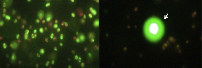 Lipid droplets before (left) and after (right) ultrasonic lysis | Photo courtesy of Los Alamos National Laboratory Lipid droplets before (left) and after (right) ultrasonic lysis | Photo courtesy of Los Alamos National Laboratory