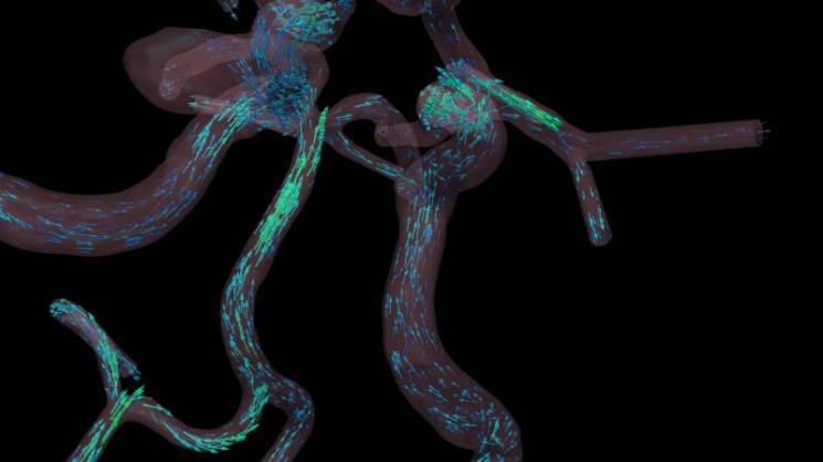 Blood flow visualization | Photo Courtesy of Argonne National Laboratory Blood flow visualization | Photo Courtesy of Argonne National Laboratory