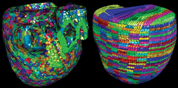 The Cardioid code developed by a team of Livermore and IBM scientists divides the heart into a large number of manageable pieces, or subdomains. The development team used two approaches, called Voronoi (left) and grid (right), to break the enormous computing challenge into much smaller individual tasks. | Photo from the Lawrence Livermore National Laboratory The Cardioid code developed by a team of Livermore and IBM scientists divides the heart into a large number of manageable pieces, or subdomains. The development team used two approaches, called Voronoi (left) and grid (right), to break the enormous computing challenge into much smaller individual tasks. | Photo from the Lawrence Livermore National Laboratory