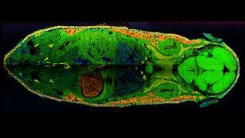 This overlay of mass spectrometry images shows the spatial distribution of three different kind of lipids across a whole mouse cross-section. Lipids act as the structural components of cell membranes and are responsible for energy storage, among other things. | Photo courtesy of Wolfgang Reindl (Berkeley Lab). This overlay of mass spectrometry images shows the spatial distribution of three different kind of lipids across a whole mouse cross-section. Lipids act as the structural components of cell membranes and are responsible for energy storage, among other things. | Photo courtesy of Wolfgang Reindl (Berkeley Lab).