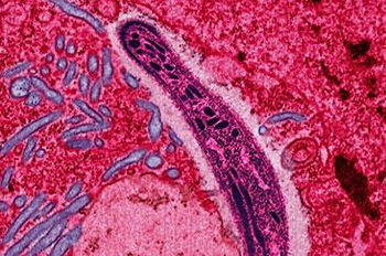The protozoan <i>Plasmodium falciparum</i> gliding through a cell in the gut of a mosquito, its primary host. Although five different species of <i>Plasmodium</i> can cause malaria, <i>Plasmodium falciparum</i> causes the most severe disease. | Photo courtesy of Wikipedia Commons. The protozoan <i>Plasmodium falciparum</i> gliding through a cell in the gut of a mosquito, its primary host. Although five different species of <i>Plasmodium</i> can cause malaria, <i>Plasmodium falciparum</i> causes the most severe disease. | Photo courtesy of Wikipedia Commons.