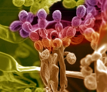 Scientists at Pacific Northwest National Laboratory study the microbial interactions in the plant root systems, the rhizosphere. The rhizosphere represents a critical zone where plant roots, microbes and minerals interface, and where biogeochemical weathering provides nutrients to plants. This research program will broaden our understanding of the biogeochemistry of plant-microbe-soil interactions. Shown are the spores of an opportunistic soil fungus Penicillium sp. that associates with the plant roots, microbial biofilms and soil minerals. | Photo courtesy of Pacific Northwest National Laboratory. Scientists at Pacific Northwest National Laboratory study the microbial interactions in the plant root systems, the rhizosphere. The rhizosphere represents a critical zone where plant roots, microbes and minerals interface, and where biogeochemical weathering provides nutrients to plants. This research program will broaden our understanding of the biogeochemistry of plant-microbe-soil interactions. Shown are the spores of an opportunistic soil fungus Penicillium sp. that associates with the plant roots, microbial biofilms and soil minerals. | Photo courtesy of Pacific Northwest National Laboratory.