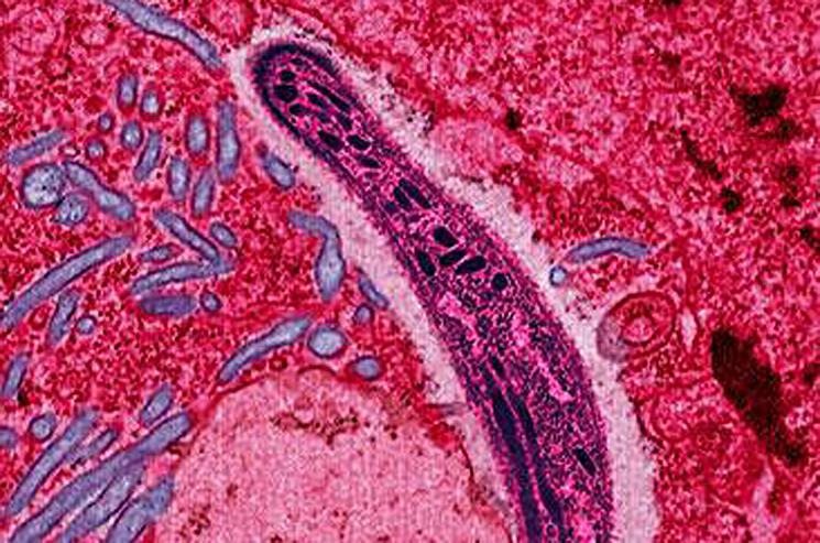 The protozoan Plasmodium falciparum gliding through a cell in the gut of a mosquito, its primary host. Although five different species of Plasmodium can cause malaria, Plasmodium falciparum causes the most severe disease. | Photo courtesy of Wikipedia Commons. <a href="http://energy.gov/articles/malaria-researchers-find-weakness-global-killer">Read more</a> The protozoan Plasmodium falciparum gliding through a cell in the gut of a mosquito, its primary host. Although five different species of Plasmodium can cause malaria, Plasmodium falciparum causes the most severe disease. | Photo courtesy of Wikipedia Commons. <a href="http://energy.gov/articles/malaria-researchers-find-weakness-global-killer">Read more</a>
